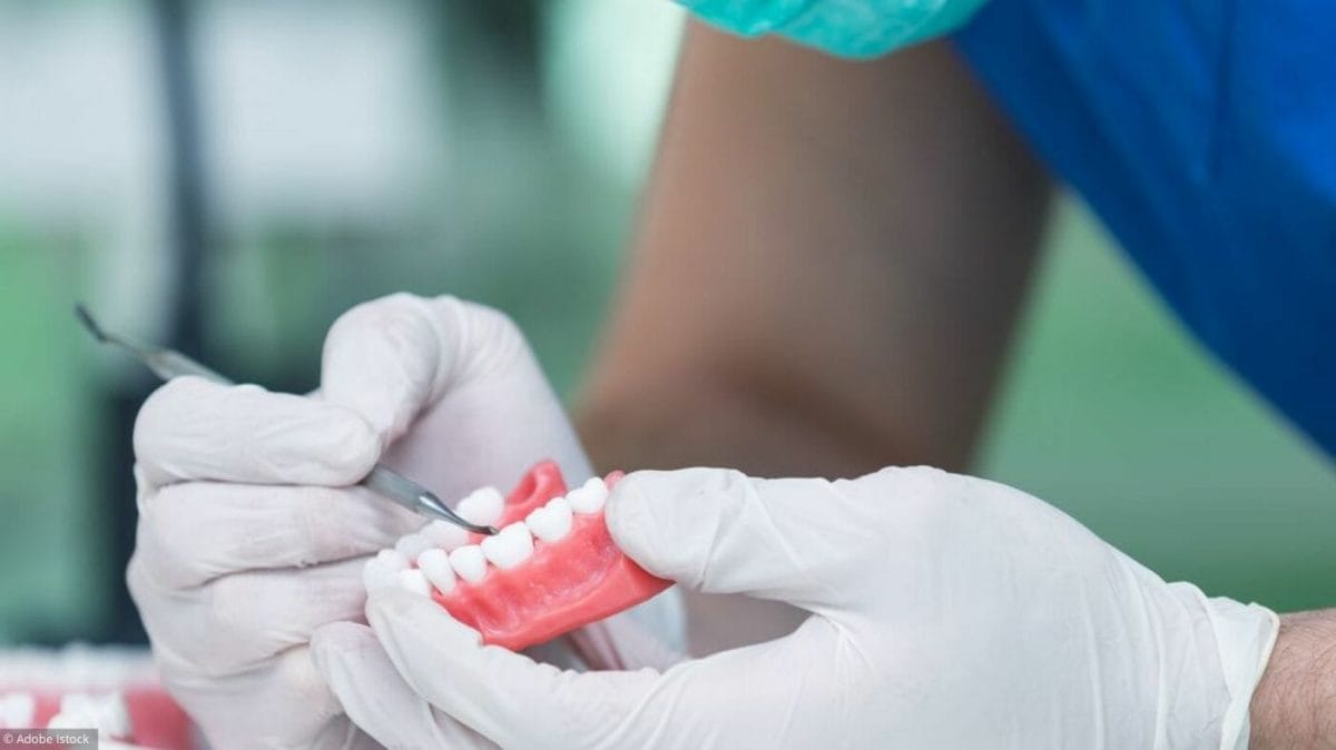 Implant dentaire : Pourquoi effectuer l’implant ?